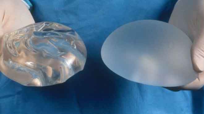 Tipos de implantes según el material de relleno: solución salina o gel de silicona